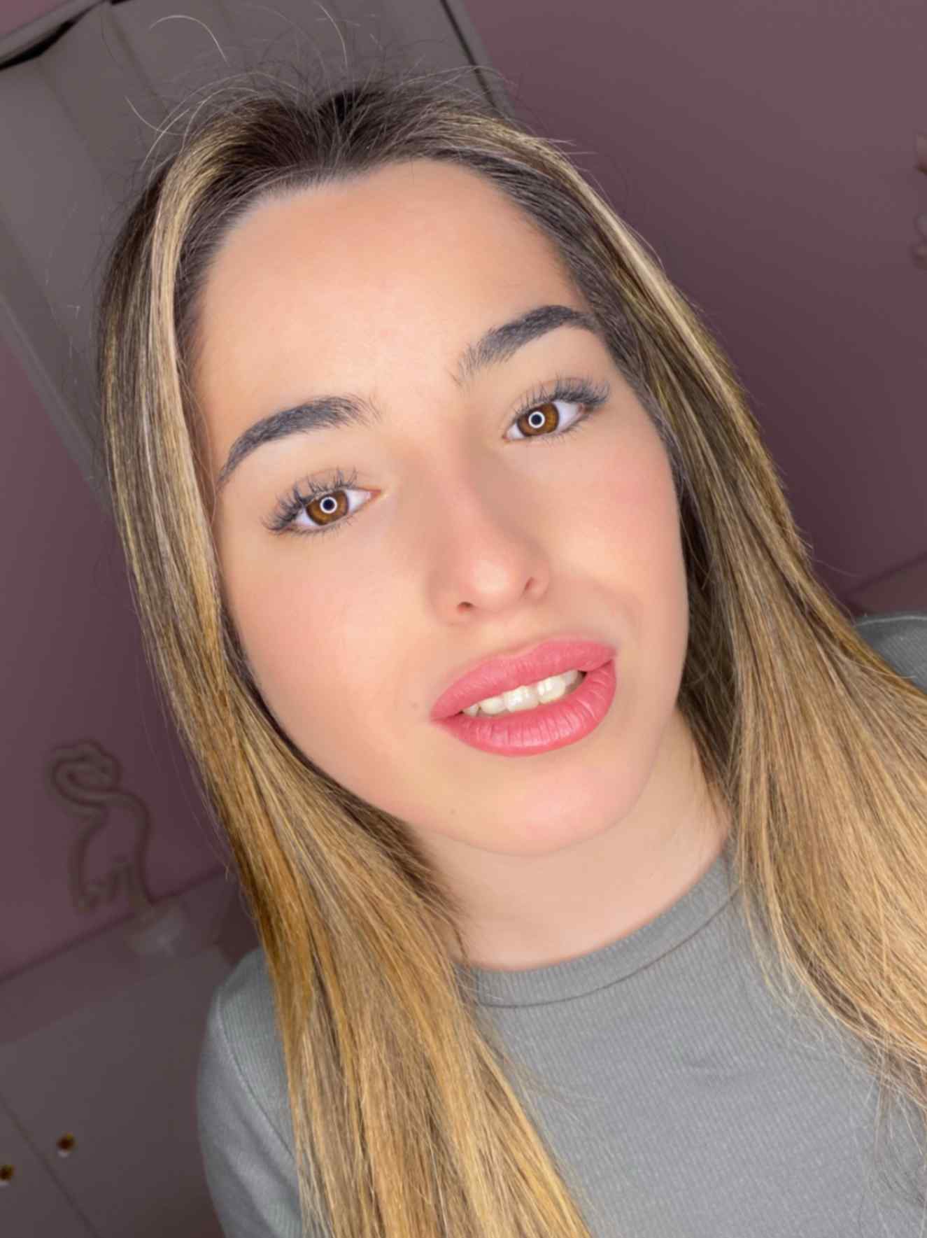 Resultado Micro labios